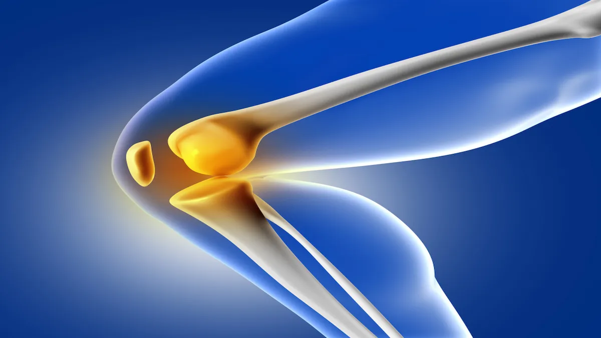 Three Dimensional Joint Preservation with Stem Cell Therapy